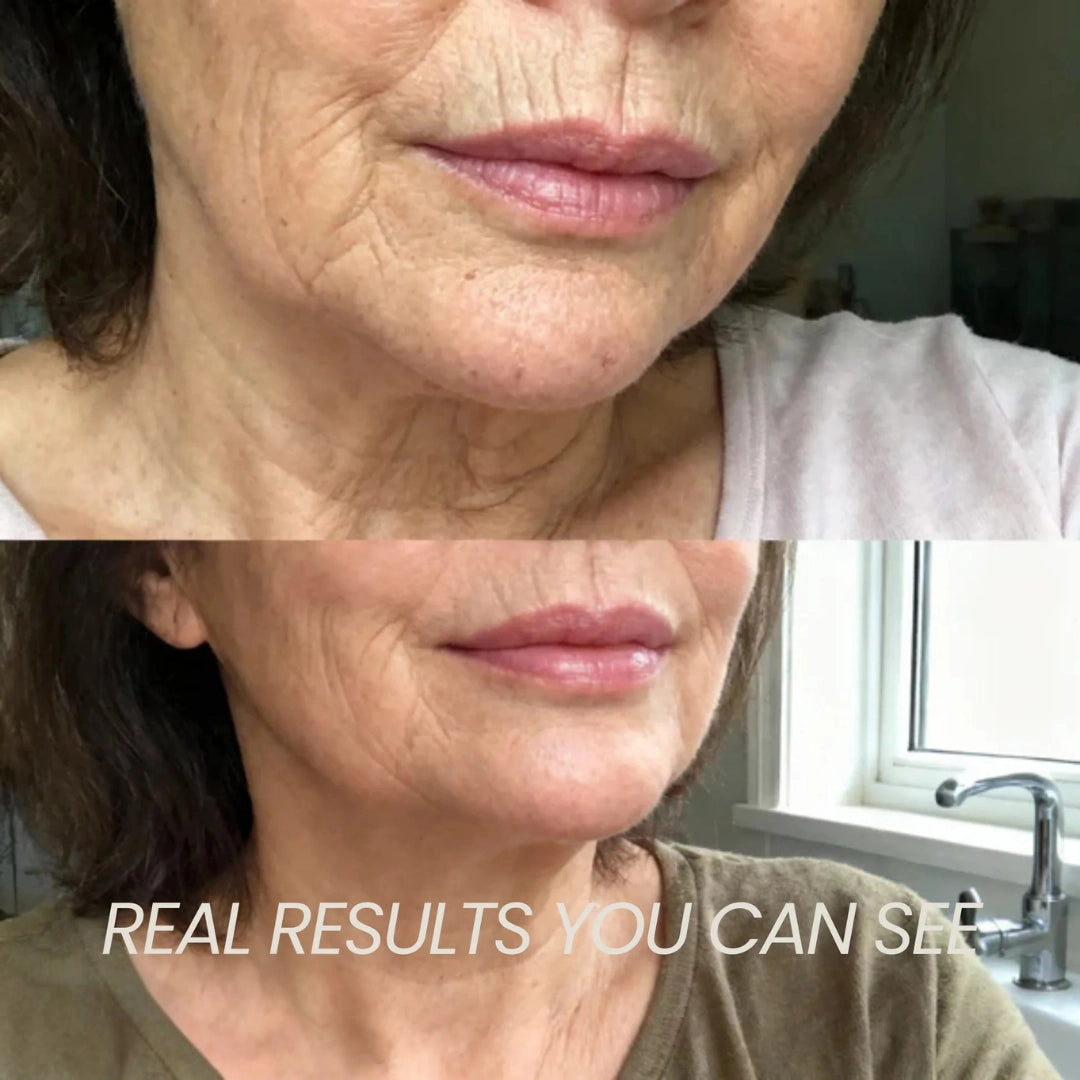 Transform Wrinkles, Fine Lines, And Tired Creases Naturally
