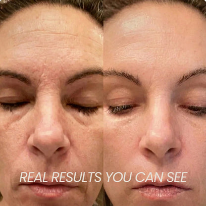 Transform Wrinkles, Fine Lines, And Tired Creases Naturally