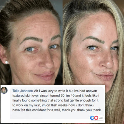 Transform Wrinkles, Fine Lines, And Tired Creases Naturally