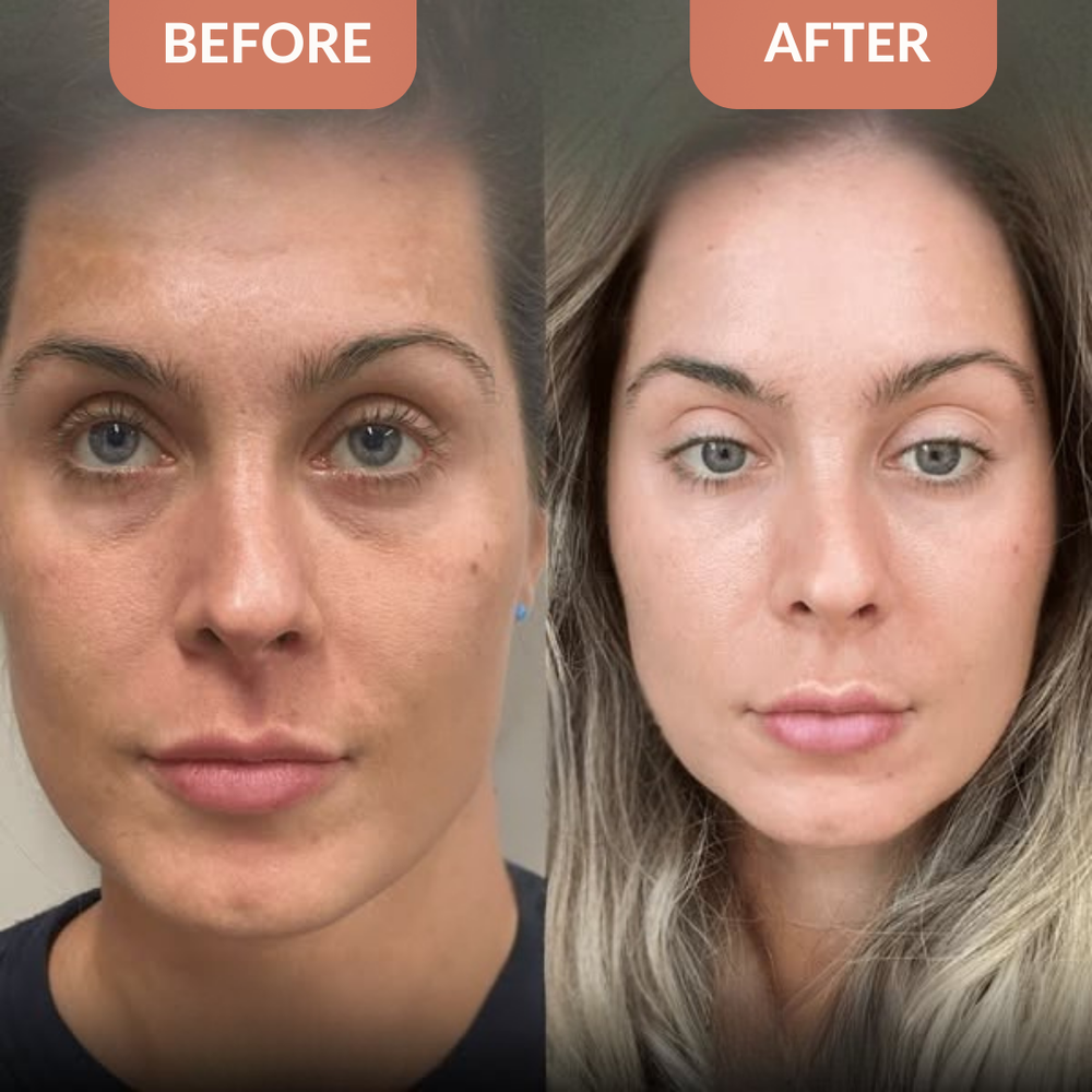 <p><strong>Why Women Are Obsessed</strong></p>